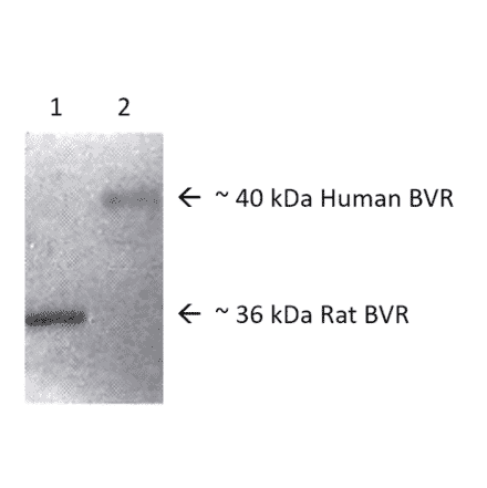 Western Blot - Anti-BVR Antibody (A304993) - Antibodies.com