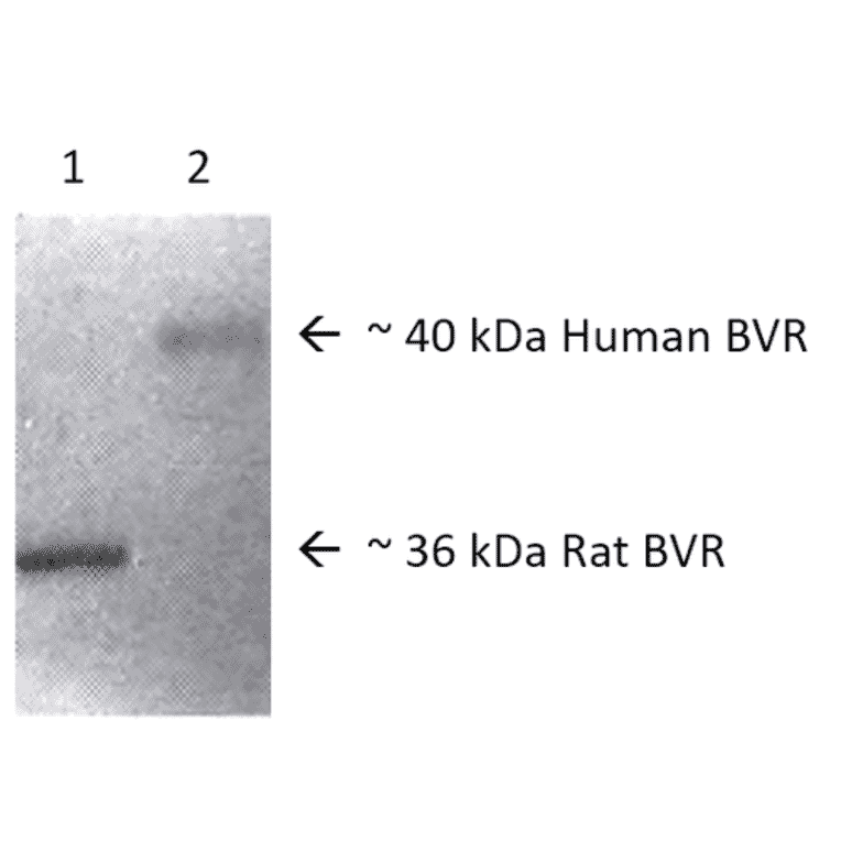 Western Blot - Anti-BVR Antibody (A304993) - Antibodies.com