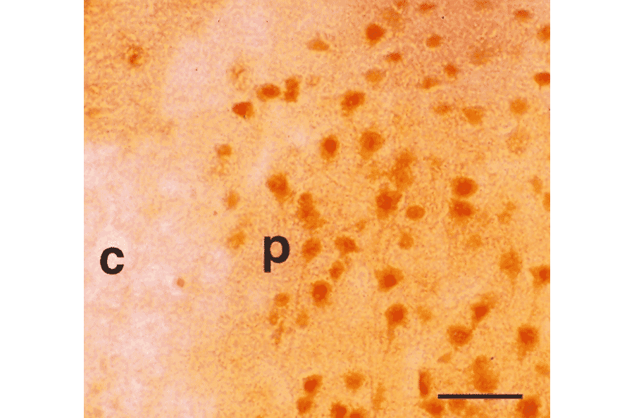 Immunohistochemistry - Anti-BVR Antibody (A304993) - Antibodies.com