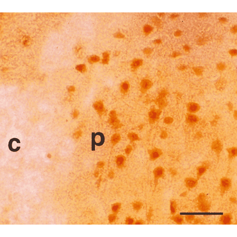 Immunohistochemistry - Anti-BVR Antibody (A304993) - Antibodies.com