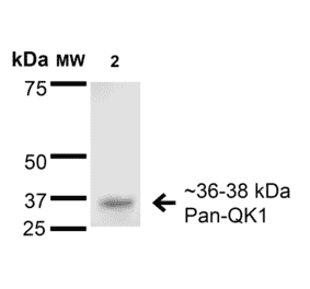 Western Blot - Anti-QKI Antibody [S147-6] (A304994) - Antibodies.com