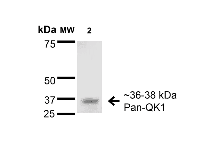 Western Blot - Anti-QKI Antibody [S147-6] (A304994) - Antibodies.com