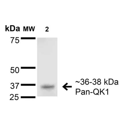 Western Blot - Anti-QKI Antibody [S147-6] (A304994) - Antibodies.com