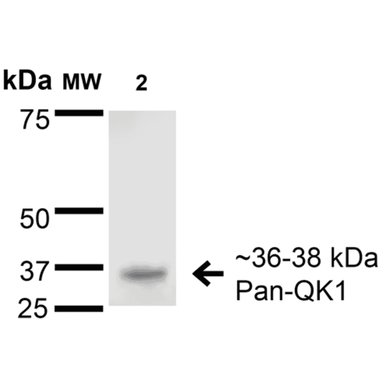 Western Blot - Anti-QKI Antibody [S147-6] (A304994) - Antibodies.com