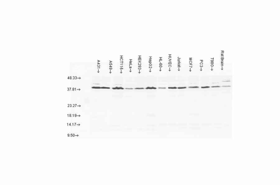 Western Blot - Anti-AHA1 Antibody (A304995) - Antibodies.com