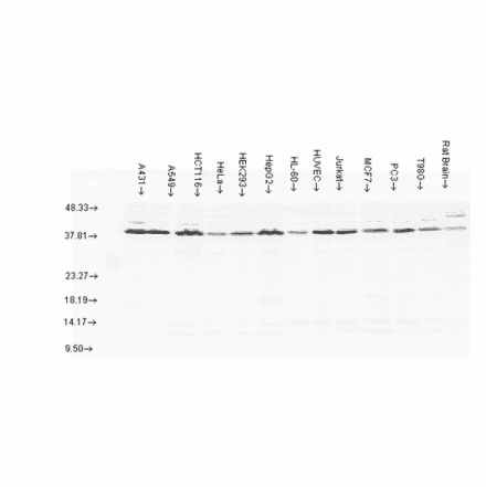 Western Blot - Anti-AHA1 Antibody (A304995) - Antibodies.com