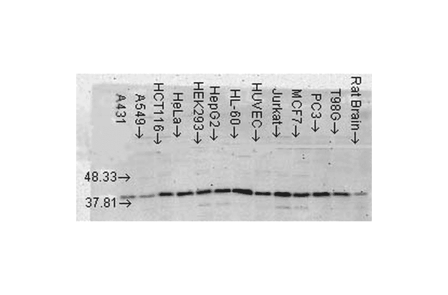 Western Blot - Anti-p38 alpha / MAPK14 Antibody [9F12] (A304996) - Antibodies.com