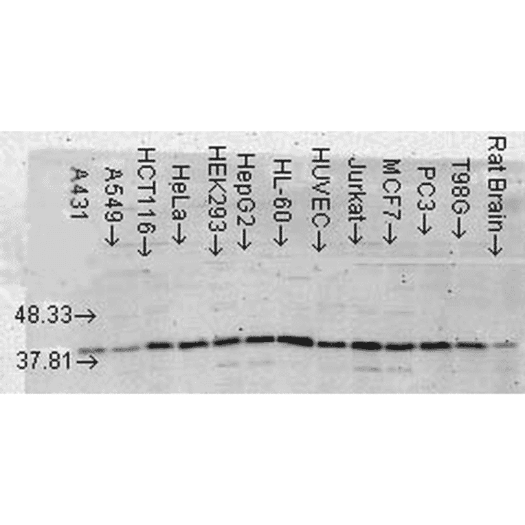 Western Blot - Anti-p38 alpha / MAPK14 Antibody [9F12] (A304996) - Antibodies.com