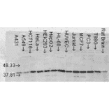 Western Blot - Anti-p38 alpha / MAPK14 Antibody [9F12] (A304996) - Antibodies.com