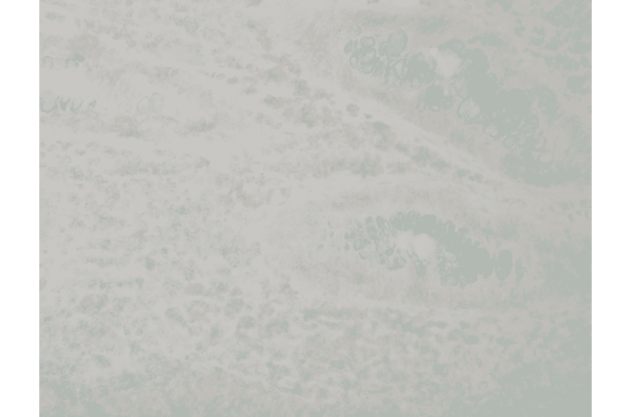 Immunohistochemistry - Anti-p38 alpha / MAPK14 Antibody [9F12] (A304996) - Antibodies.com