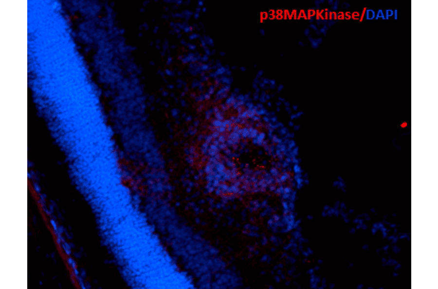 Immunohistochemistry - Anti-p38 alpha / MAPK14 Antibody [9F12] (A304996) - Antibodies.com