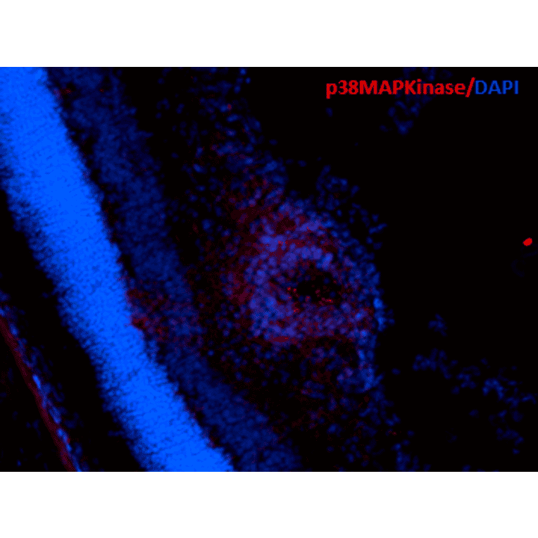 Immunohistochemistry - Anti-p38 alpha / MAPK14 Antibody [9F12] (A304996) - Antibodies.com