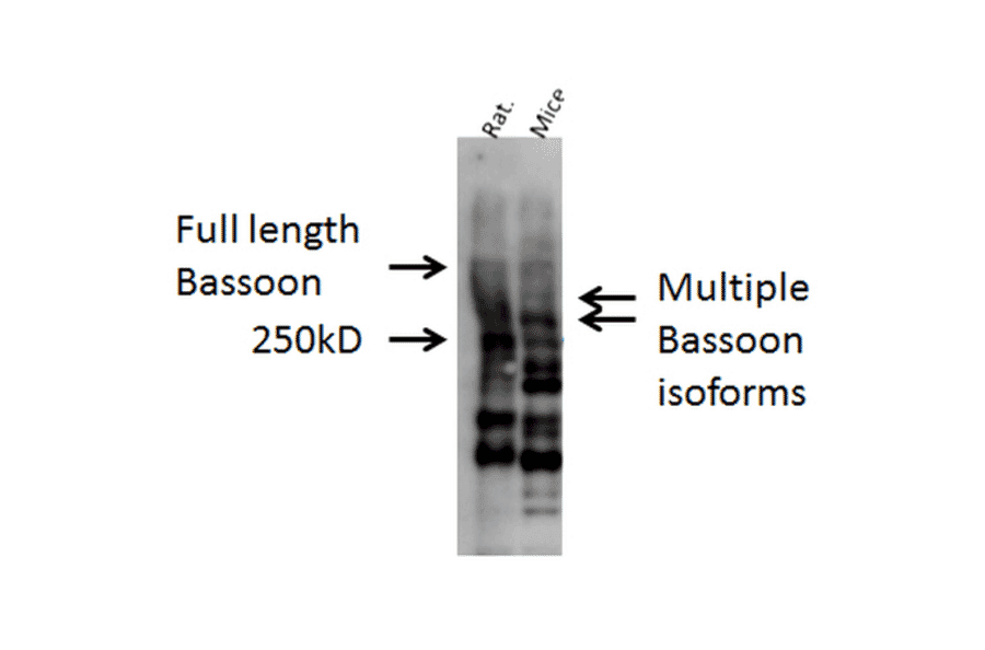 Western Blot - Anti-Bassoon Antibody (A304999) - Antibodies.com