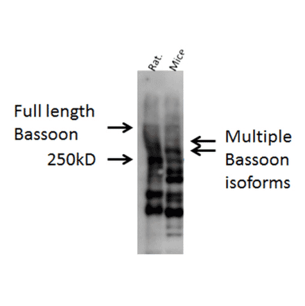 Western Blot - Anti-Bassoon Antibody (A304999) - Antibodies.com