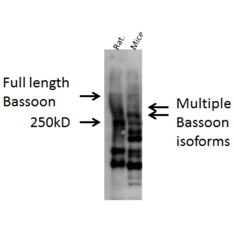 Western Blot - Anti-Bassoon Antibody (A304999) - Antibodies.com