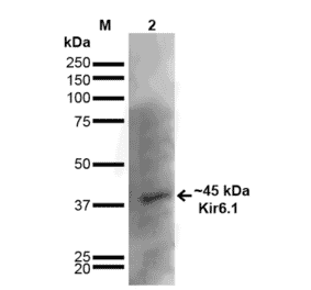 Western Blot - Anti-Kir6.1 Antibody [S366-60] (A305001) - Antibodies.com