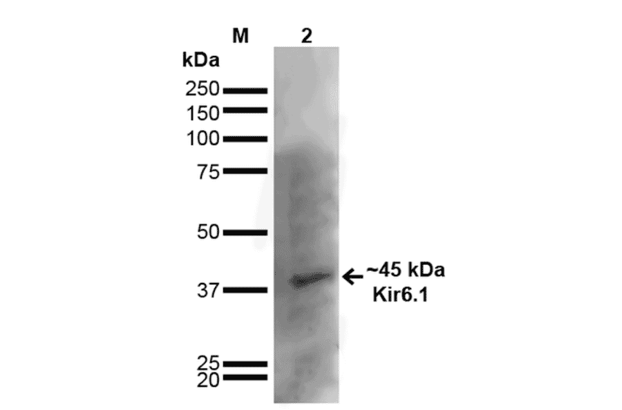 Western Blot - Anti-Kir6.1 Antibody [S366-60] (A305001) - Antibodies.com