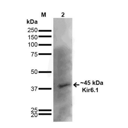 Western Blot - Anti-Kir6.1 Antibody [S366-60] (A305001) - Antibodies.com