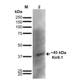 Western Blot - Anti-Kir6.1 Antibody [S366-60] (A305001) - Antibodies.com