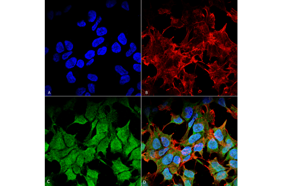 Immunocytochemistry/Immunofluorescence - Anti-Kir6.1 Antibody [S366-60] (A305001) - Antibodies.com