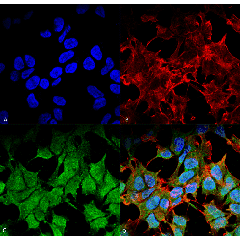 Immunocytochemistry/Immunofluorescence - Anti-Kir6.1 Antibody [S366-60] (A305001) - Antibodies.com