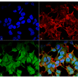 Immunocytochemistry/Immunofluorescence - Anti-Kir6.1 Antibody [S366-60] (A305001) - Antibodies.com