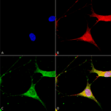Immunocytochemistry/Immunofluorescence - Anti-Kir6.1 Antibody [S366-60] (A305001) - Antibodies.com