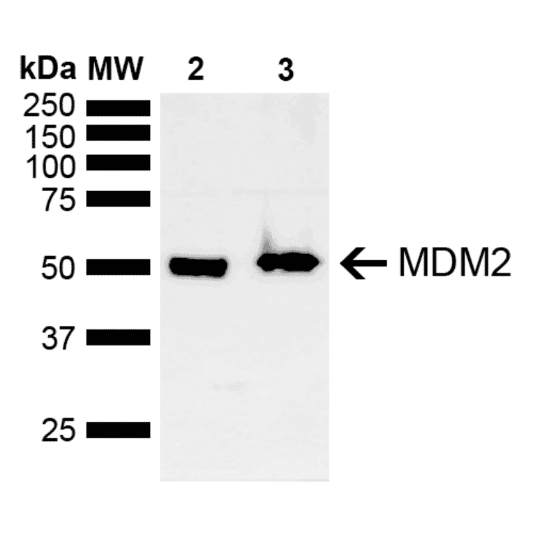 Western Blot - Anti-MDM2 Antibody (A305002) - Antibodies.com