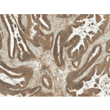 Immunohistochemistry - Anti-MDM2 Antibody (A305002) - Antibodies.com