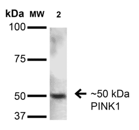Western Blot - Anti-PINK1 Antibody [S4-15] (A305003) - Antibodies.com