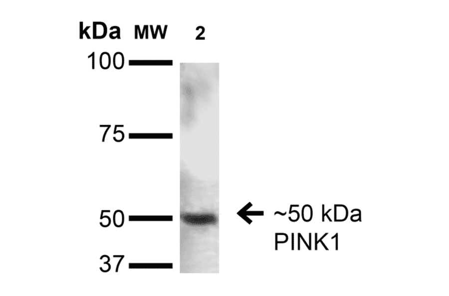 Western Blot - Anti-PINK1 Antibody [S4-15] (A305003) - Antibodies.com