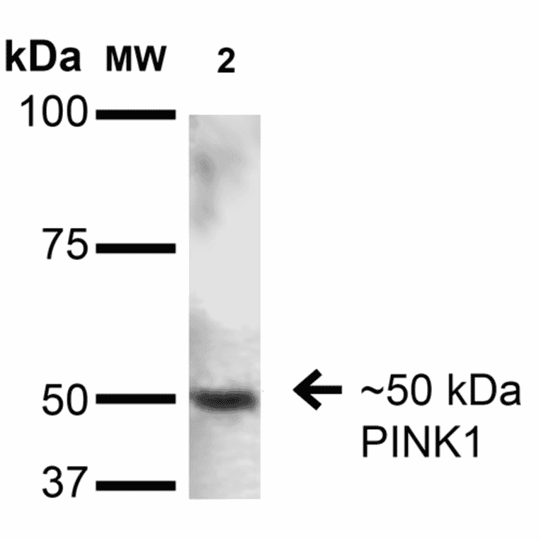 Western Blot - Anti-PINK1 Antibody [S4-15] (A305003) - Antibodies.com