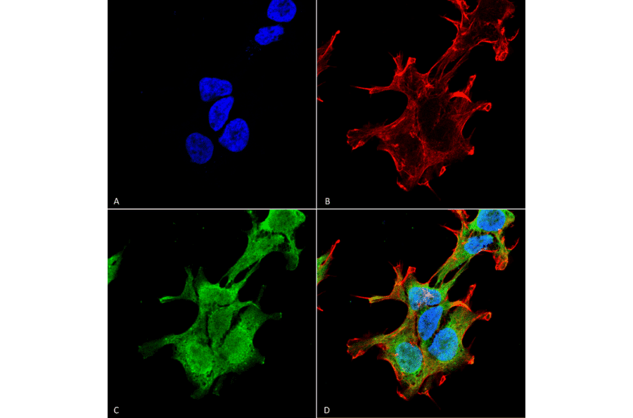 Immunocytochemistry/Immunofluorescence - Anti-PINK1 Antibody [S4-15] (A305003) - Antibodies.com