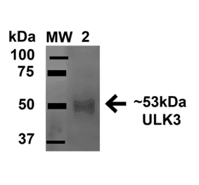 Western Blot - Anti-ULK3 Antibody (A305005) - Antibodies.com