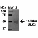 Western Blot - Anti-ULK3 Antibody (A305005) - Antibodies.com