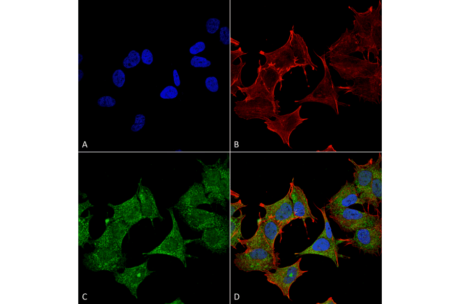 Immunocytochemistry/Immunofluorescence - Anti-ULK3 Antibody (A305005) - Antibodies.com