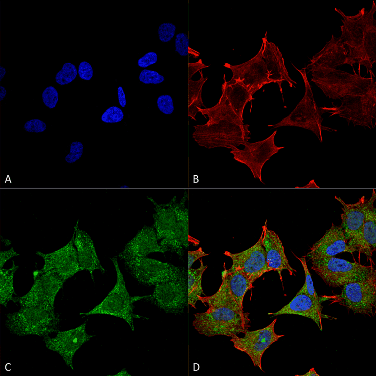 Immunocytochemistry/Immunofluorescence - Anti-ULK3 Antibody (A305005) - Antibodies.com
