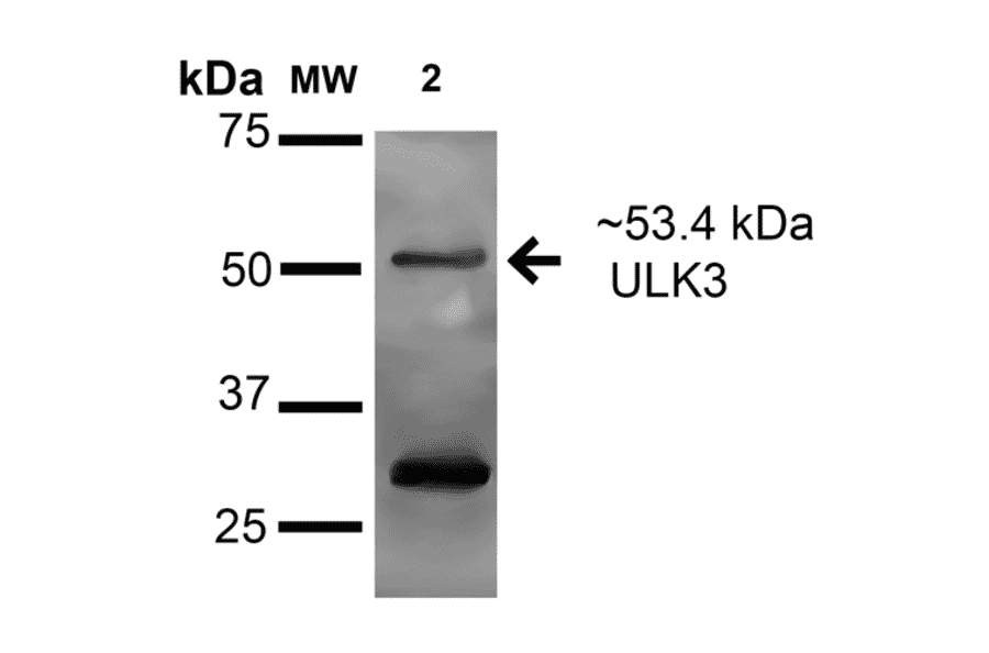 Western Blot - Anti-ULK3 Antibody (A305005) - Antibodies.com
