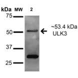 Western Blot - Anti-ULK3 Antibody (A305005) - Antibodies.com
