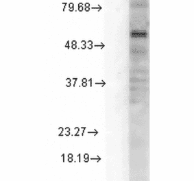 Western Blot - Anti-GABRD Antibody [N151/3] (A305006) - Antibodies.com