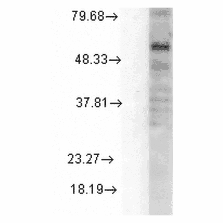 Western Blot - Anti-GABRD Antibody [N151/3] (A305006) - Antibodies.com