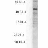 Western Blot - Anti-GABRD Antibody [N151/3] (A305006) - Antibodies.com