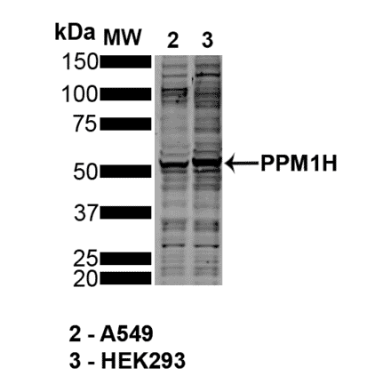 Western Blot - Anti-PPM1H Antibody [10D2] (A305007) - Antibodies.com