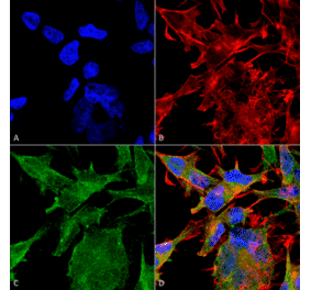 Immunocytochemistry/Immunofluorescence - Anti-VAChT Antibody [S6-38] (A305008) - Antibodies.com