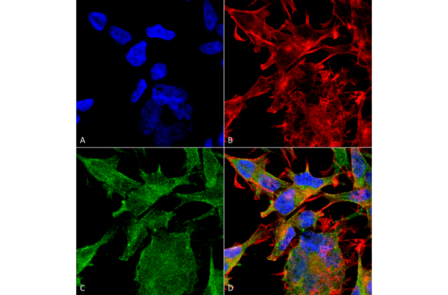 Immunocytochemistry/Immunofluorescence - Anti-VAChT Antibody [S6-38] (A305008) - Antibodies.com