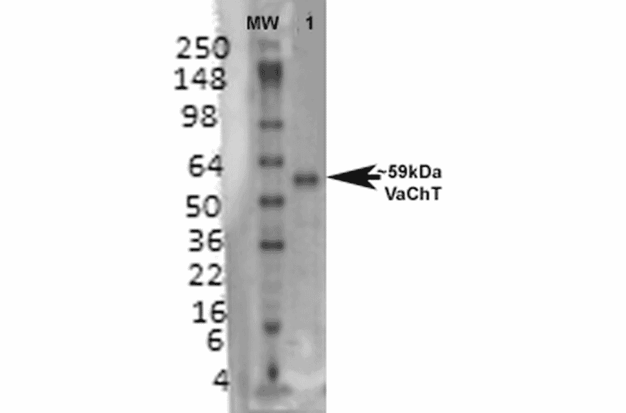 Western Blot - Anti-VAChT Antibody [S6-38] (A305008) - Antibodies.com