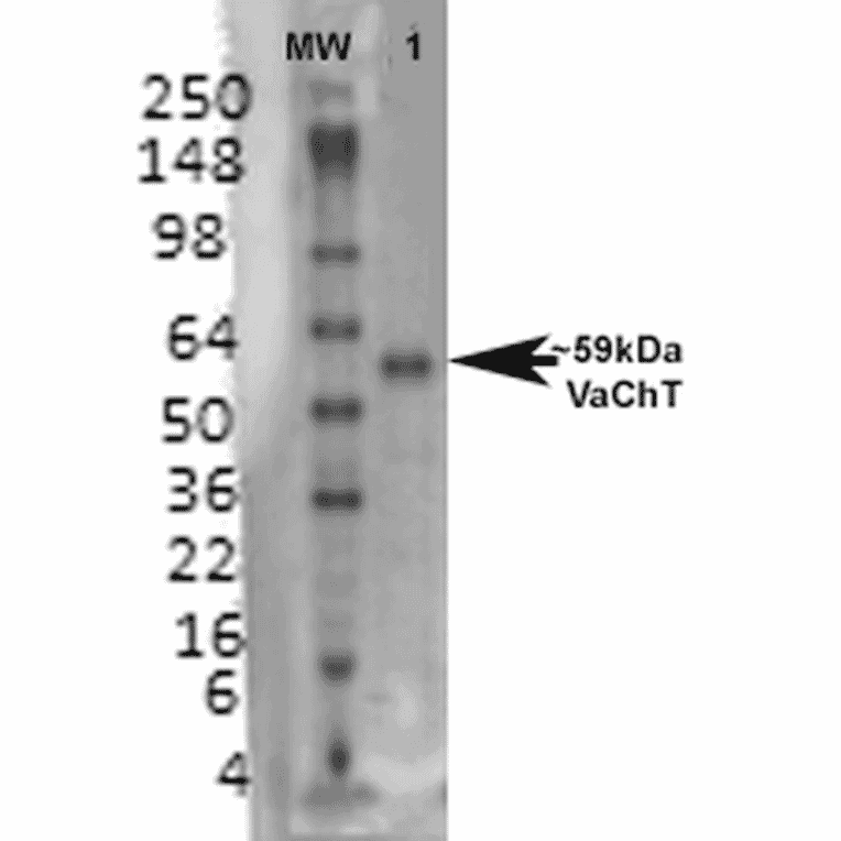 Western Blot - Anti-VAChT Antibody [S6-38] (A305008) - Antibodies.com