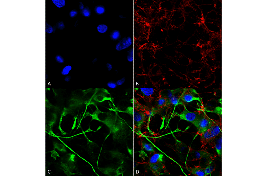 ICC/IF of SH-SY5Y cells using Anti-VAChT Antibody [S6-38] (A305008)