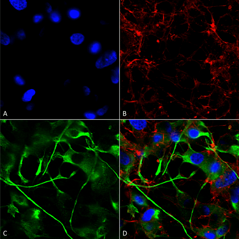 Immunocytochemistry/Immunofluorescence - Anti-VAChT Antibody [S6-38] (A305008) - Antibodies.com