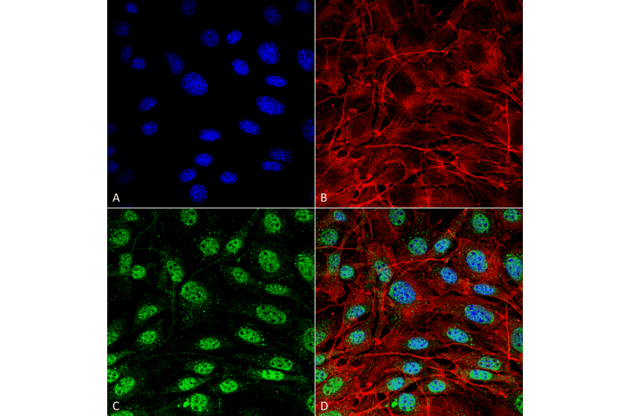 Immunocytochemistry/Immunofluorescence - Anti-SQSTM1 / p62 Antibody (A305009) - Antibodies.com